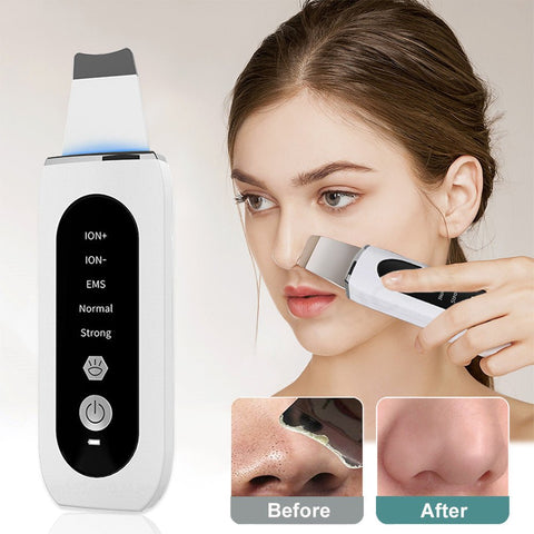 Shovel Skin Blackhead Ultrasonic Beauty Microcurrent Color Light